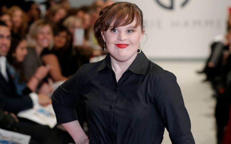 Jamie Brewer - Celebrities with Turner Syndrome